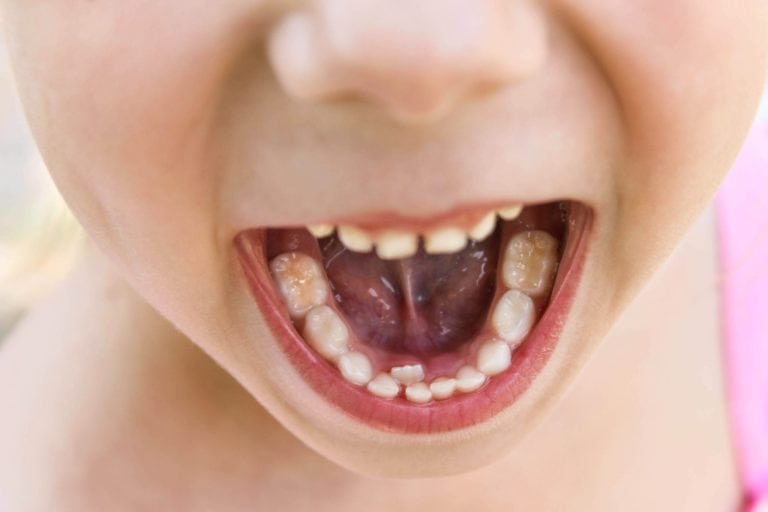 view of the inside of a child mouth