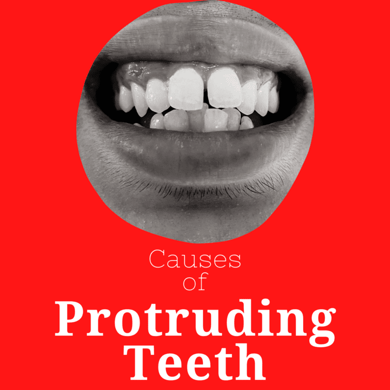 causes of protruding teeth