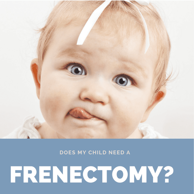 Does my child need a frenectomy