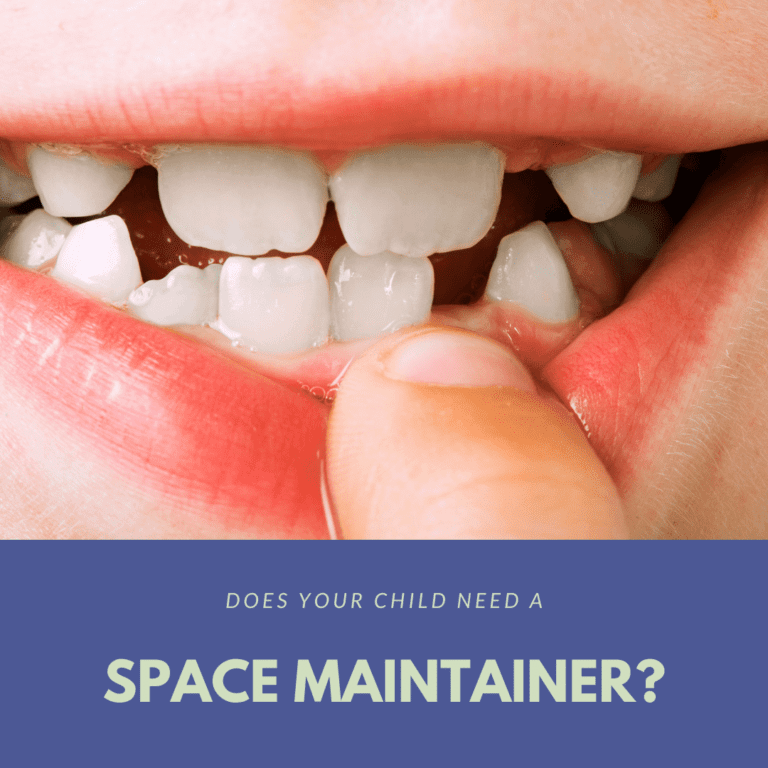 Does Your Child Need A space maintainer