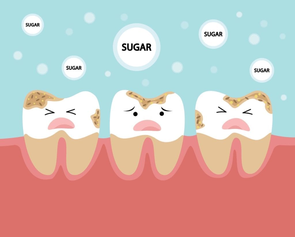 teeth being attacked by sugar