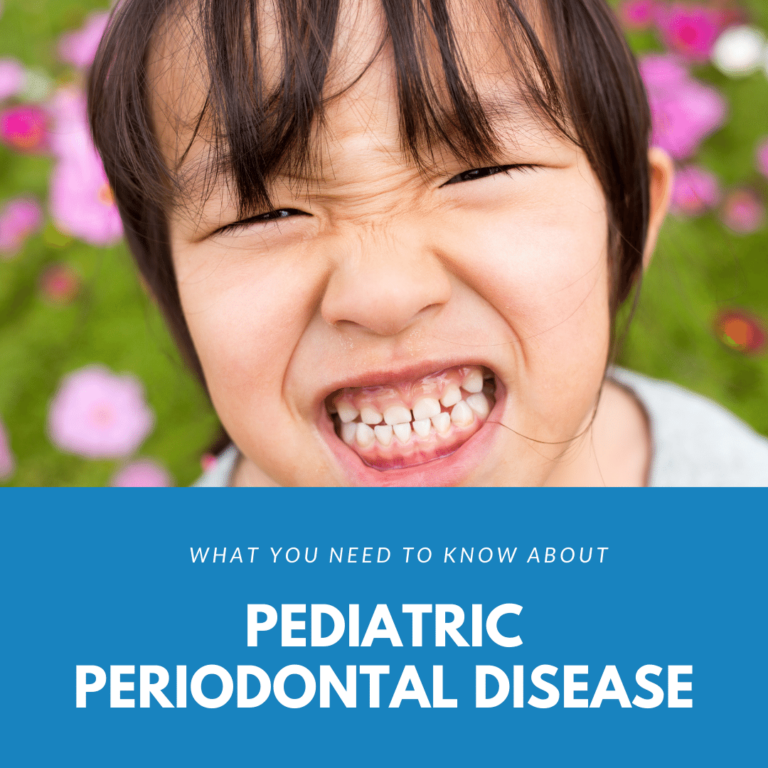 What You Need to Know About pediatric periodontal disease
