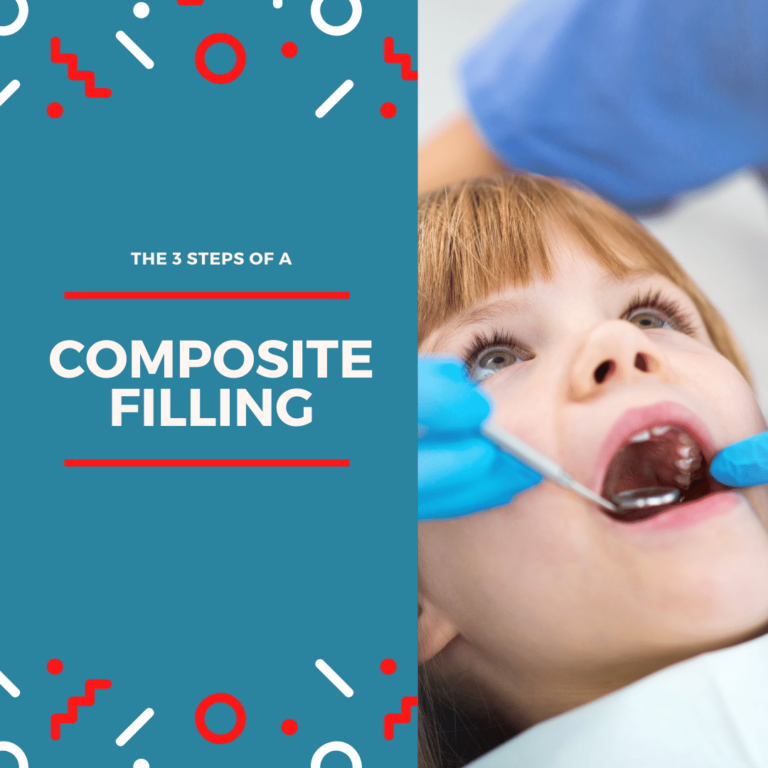 The 3 steps of a composite filling (1)