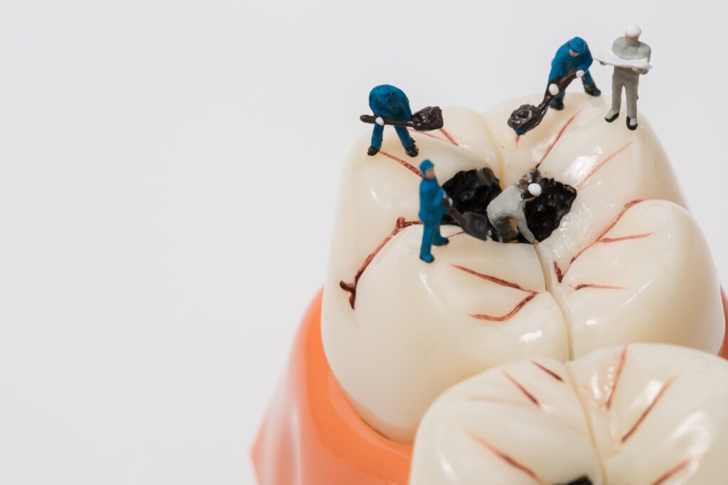 mini construction workers removing decay from a fake tooth