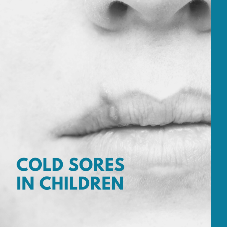 Cold Sores in Children