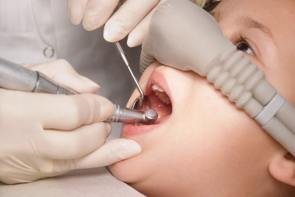 child receiving nitrous oxide sedation