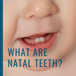 What are Natal Teeth