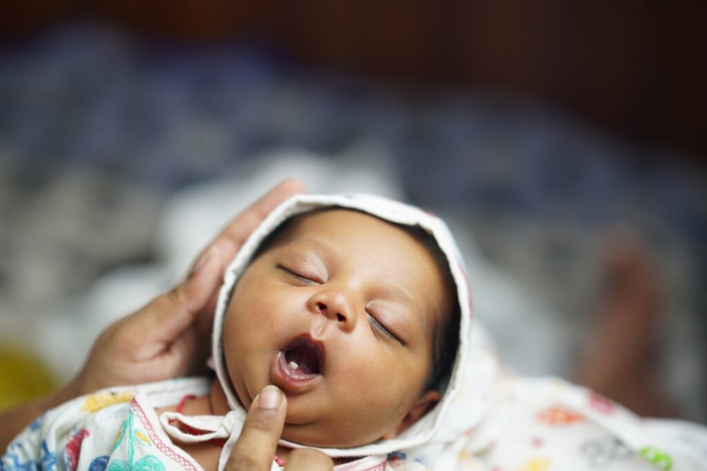 newborn with natal teeth