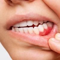 img-Swelling or Infection