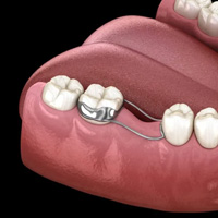 img-Space Maintainers