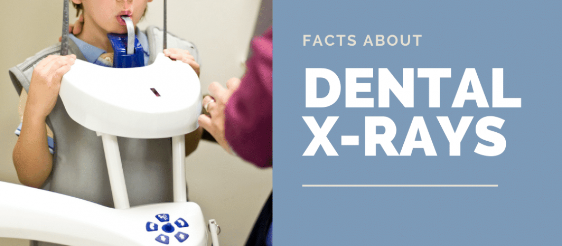 Facts About dental xrays
