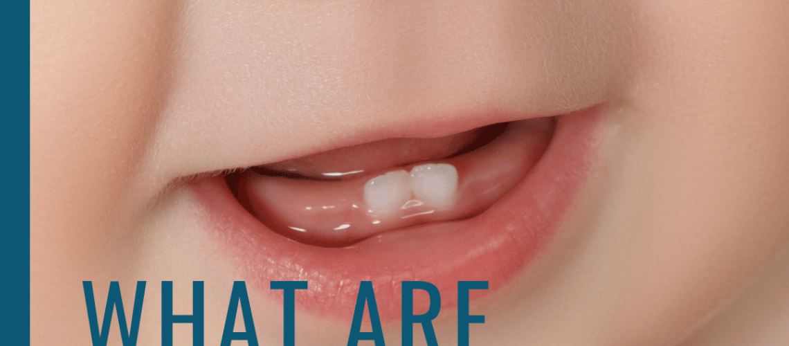 What are Natal Teeth